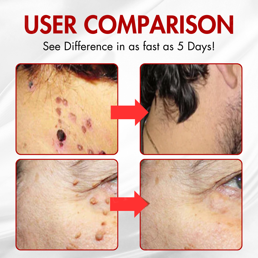 ✨AEXZR® Nano-Microdart Patches – 🌿Dual-Release Tech, Painless Tag Removal🩹