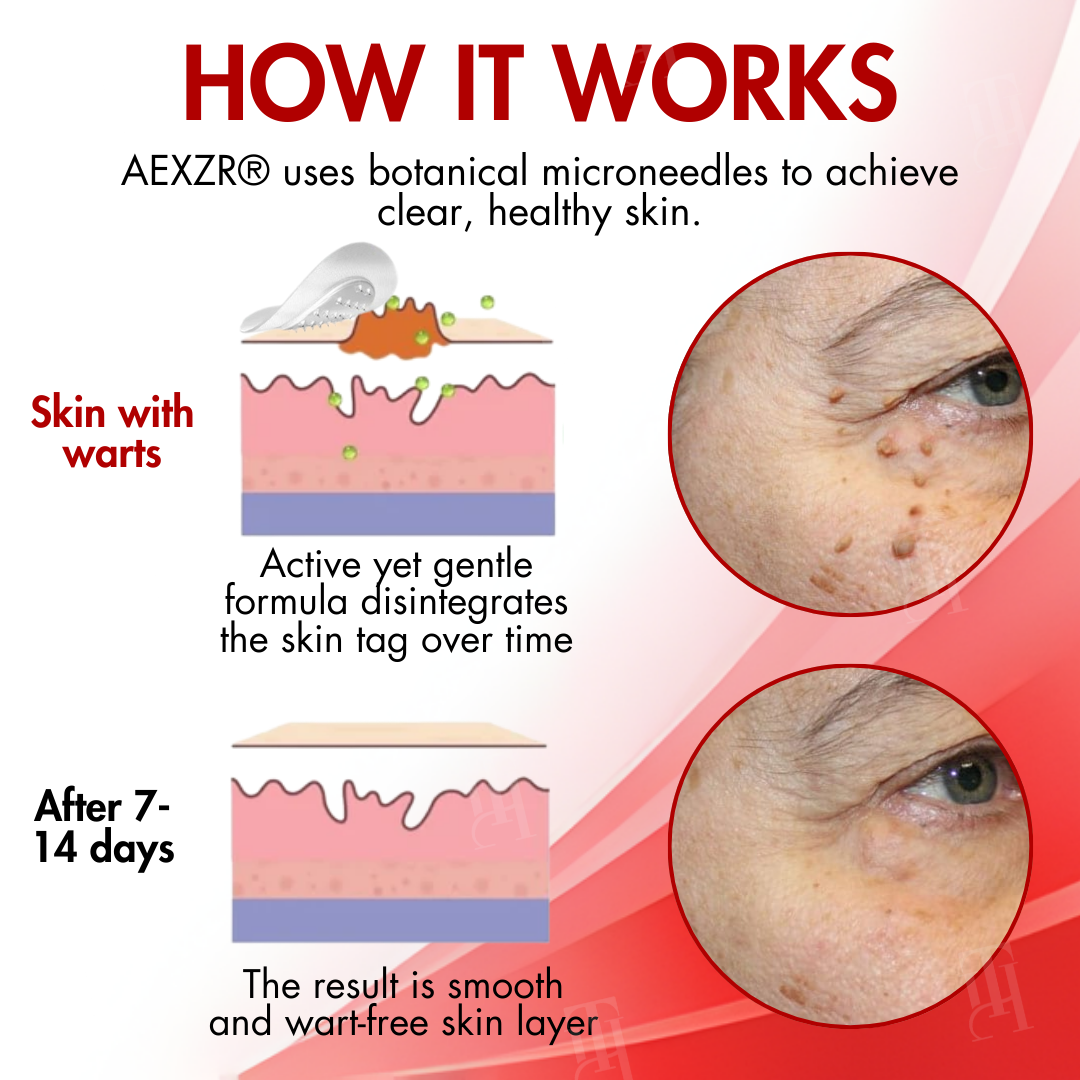 ✨AEXZR® Nano-Microdart Patches – 🌿Dual-Release Tech, Painless Tag Removal🩹